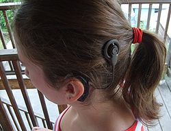 Las nuevas tecnologías están posibilitando que muchos niños que padecen sordera bilateral profunda puedan oír gracias a los implantes cocleares ¿pero qué son estos aparatos?