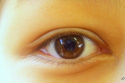 lesión ocular niño