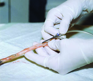 extracción sangre cordón