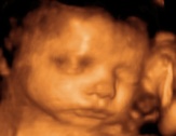 feto semana 31-33