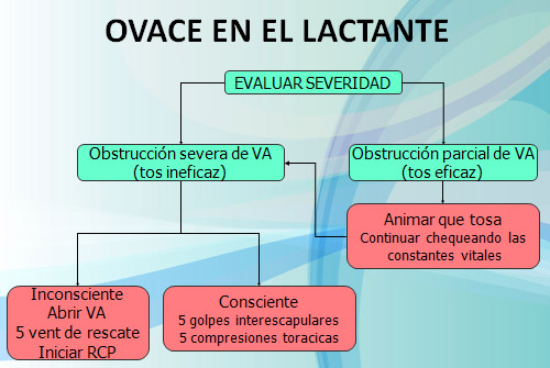 Atragantamiento Bebé